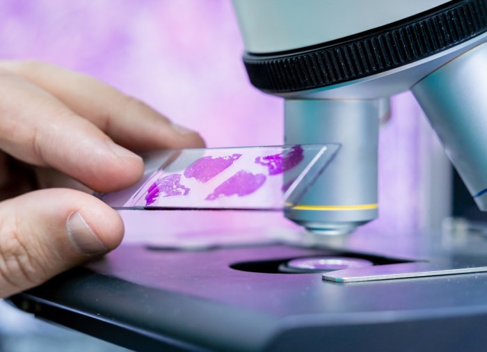 Ocena wyników cytologii według skali Papanicolau i systemu Bethesda – analiza klasyfikacji